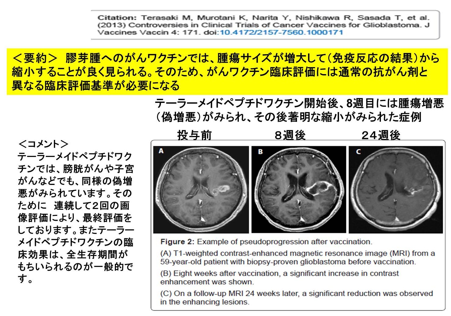 glioblastoma